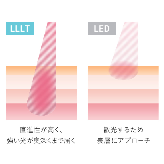 LLLT搭載